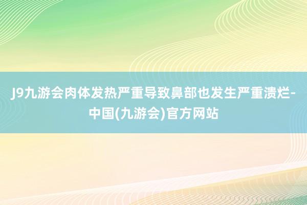 J9九游会肉体发热严重导致鼻部也发生严重溃烂-中国(九游会)官方网站